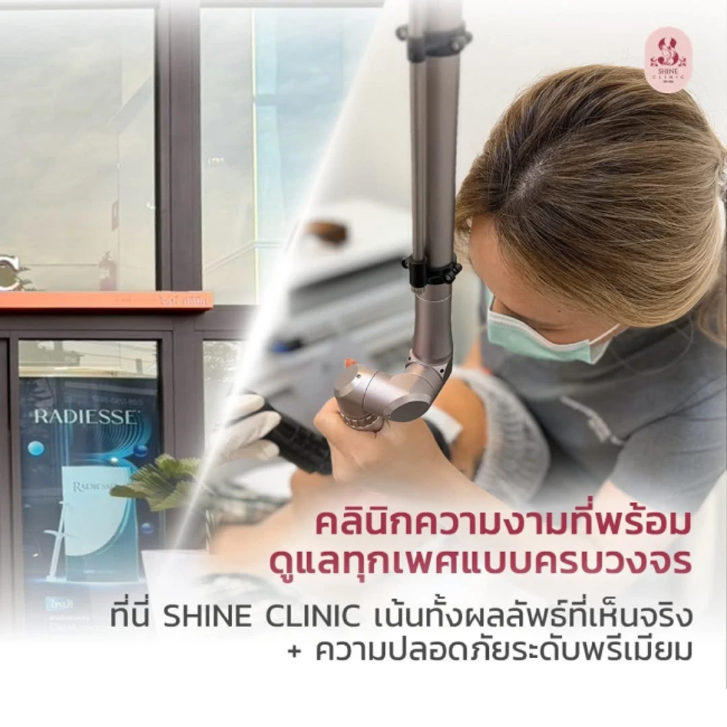 โปรแกรมโบท็อกซ์ 100 ยูนิต (หน้า)