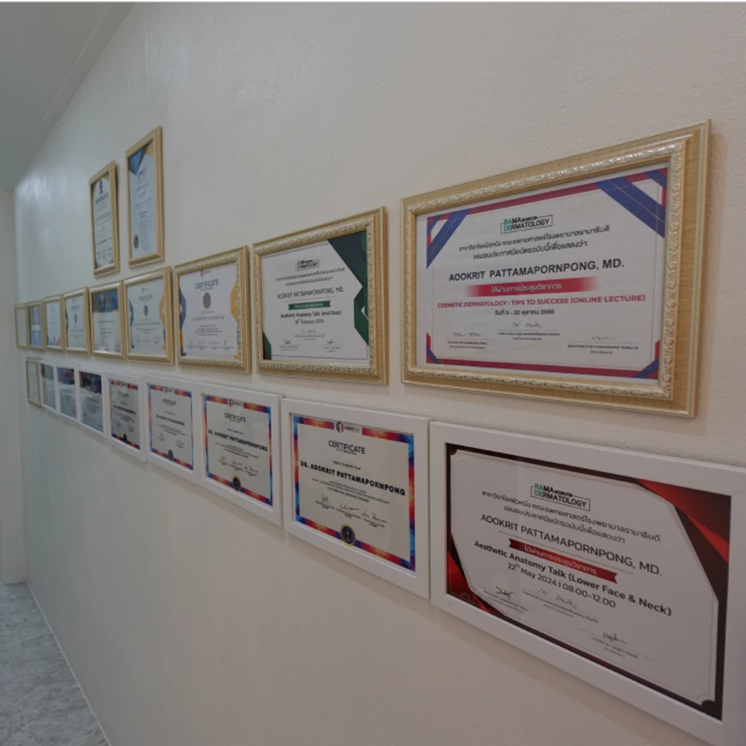 เลเซอร์ Aileen Plus Nd:YAG กำจัดขนหนวด + เครา 1 ครั้ง