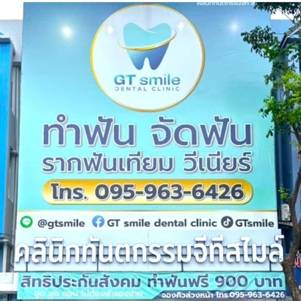 ทำวีเนียร์คอมโพสิต 16 ซี่