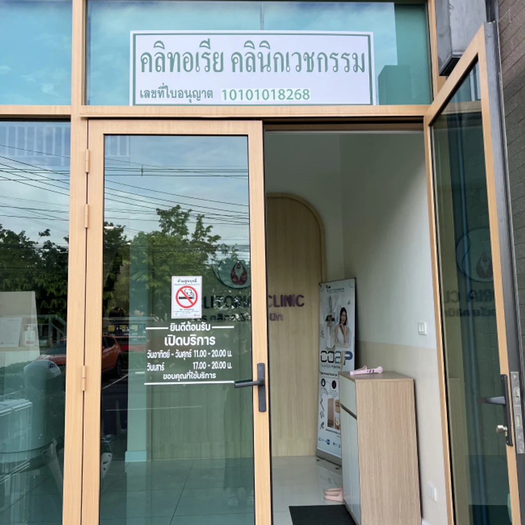 เลเซอร์ Diode 4 คลื่นพลังงาน กำจัดขน Hollywood (vVIO)