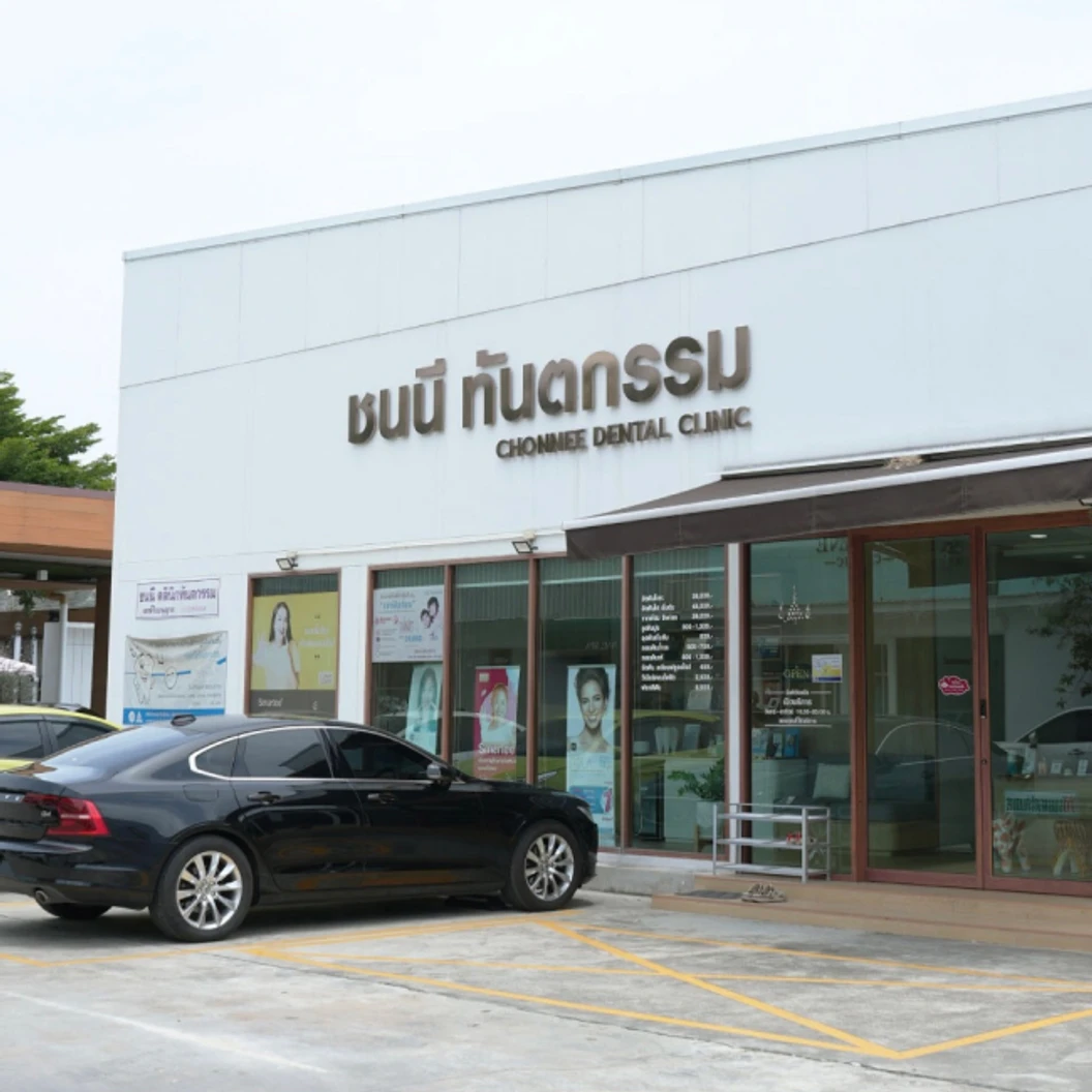 ทำรีเทนเนอร์แบบใส 2 ชิ้น