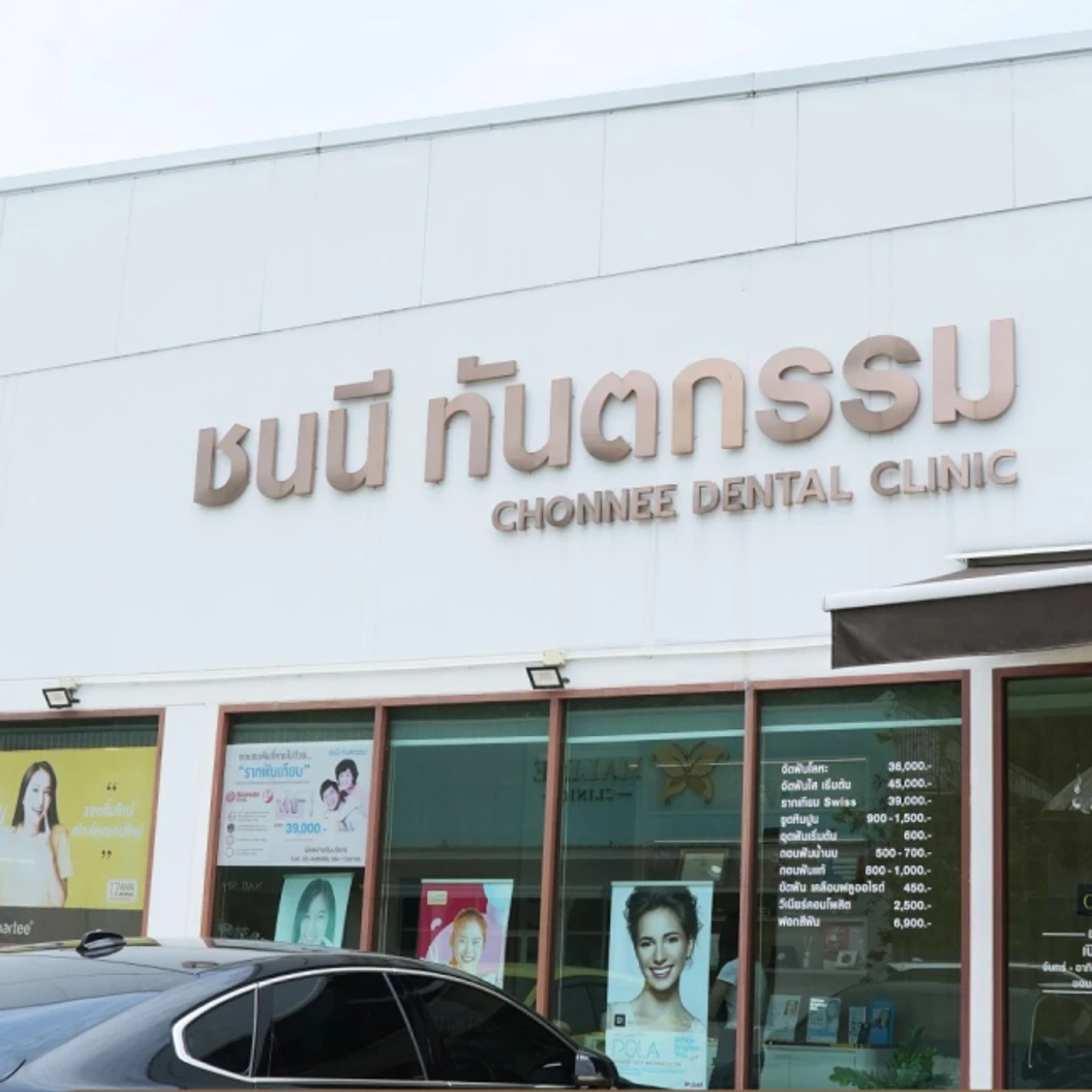 ทำรีเทนเนอร์แบบใส 2 ชิ้น