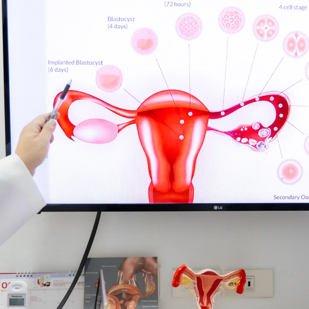 ตรวจภาวะมีบุตรยาก แพ็กคู่ ผู้หญิง 7 รายการ และผู้ชาย 6 รายการ โดย นพ. กิตติ ฉัตรตระกูลชัย