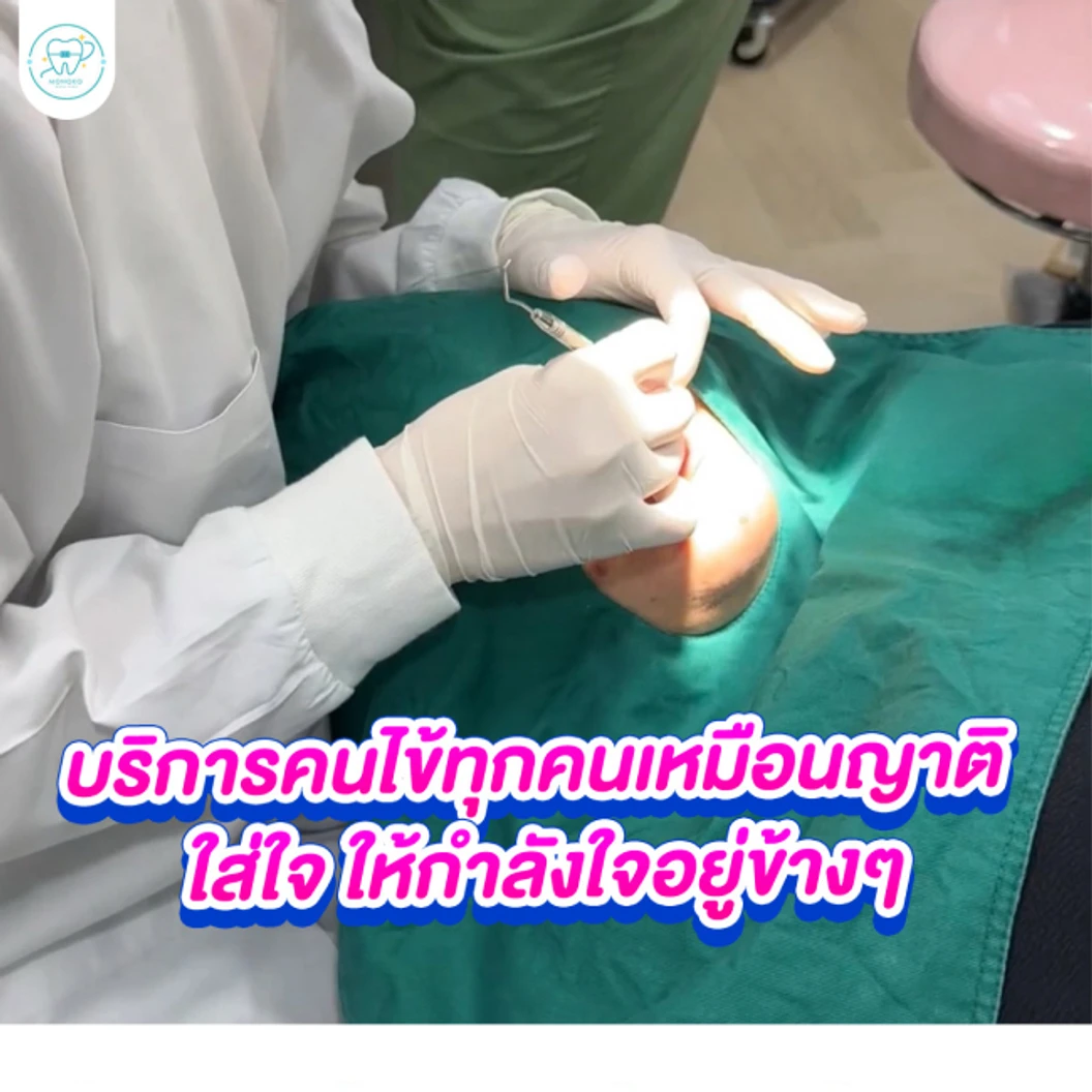 เคลือบหลุมร่องฟัน 1 ซี่