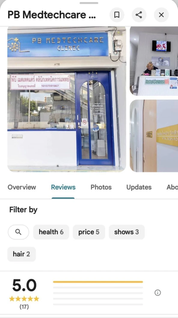 ตรวจคัดกรองไวรัสตับอักเสบ 4 รายการ