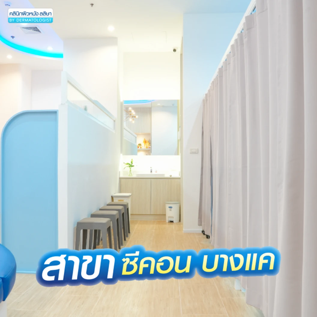 โปรแกรมเลเซอร์ Vbeam Perfecta ลดรอยแดงจากสิว 100 ช็อต