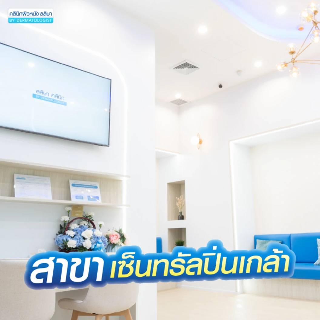 โปรแกรมเลเซอร์ Vbeam Perfecta ลดรอยแดงจากสิว 100 ช็อต