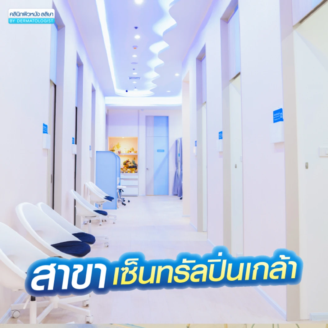 โปรแกรมเลเซอร์ Vbeam Perfecta ลดรอยแดงจากสิว 100 ช็อต