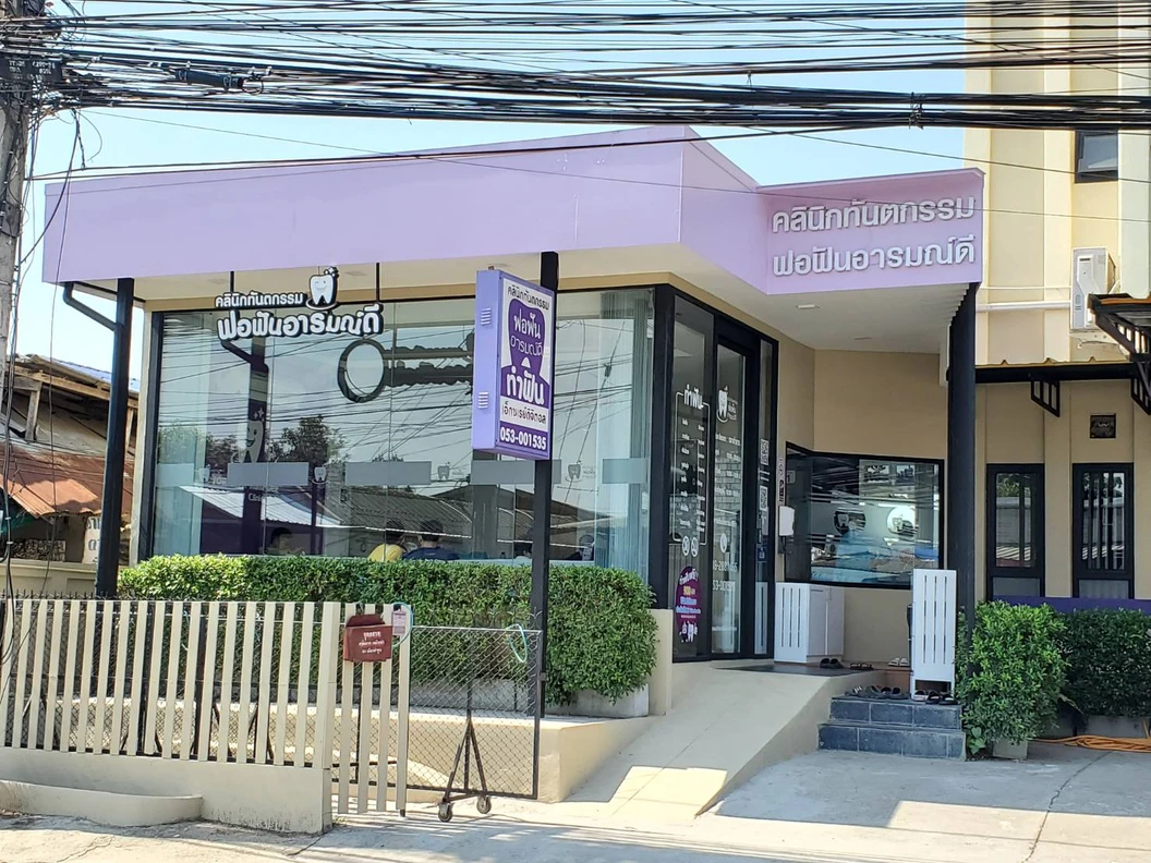 ทำรีเทนเนอร์แบบลวด 2 ชิ้น ฟันบนและล่าง