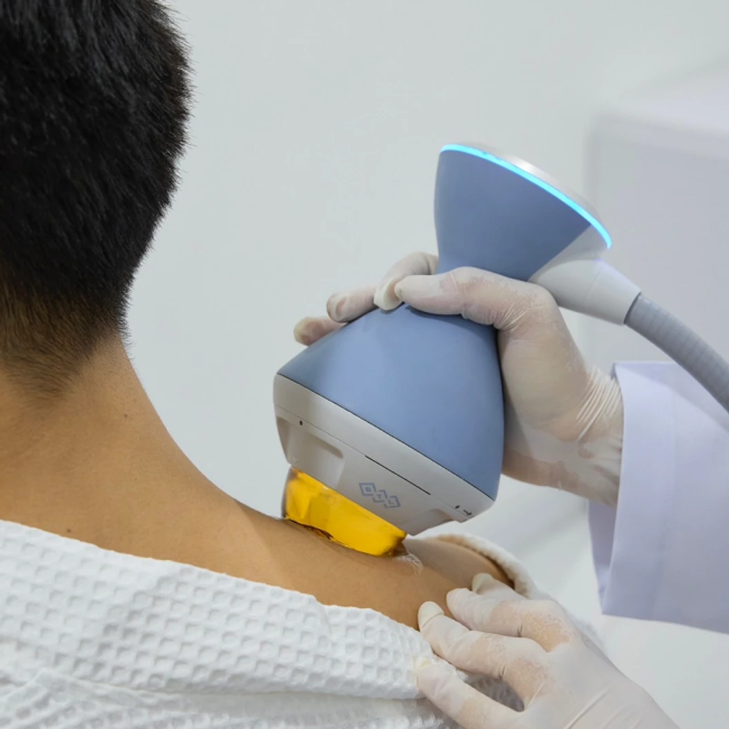 เสริมสมรรถภาพทางเพศ กระตุ้นการไหลเวียนเฉพาะจุด ด้วย Focused Shockwave Therapy สำหรับผู้ชาย 1 ครั้ง