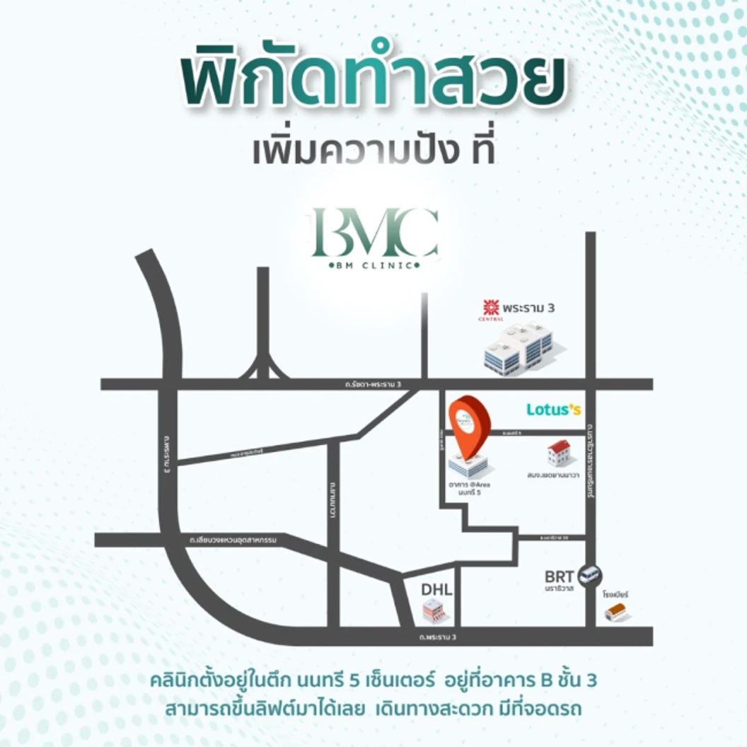 โปรแกรม IPL กำจัดขนรักแร้ 1 ครั้ง