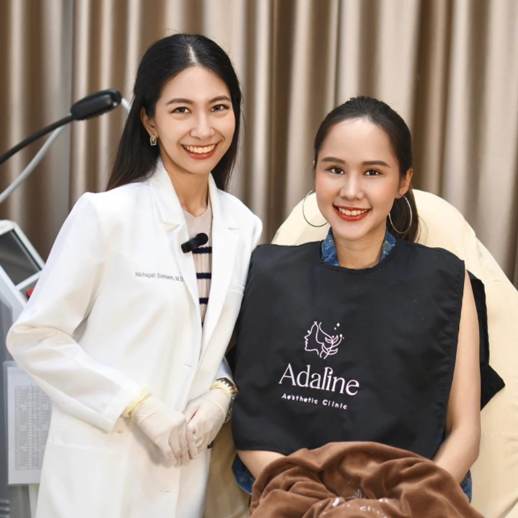 โปรแกรมโบท็อกซ์ 100 ยูนิต (หน้า)