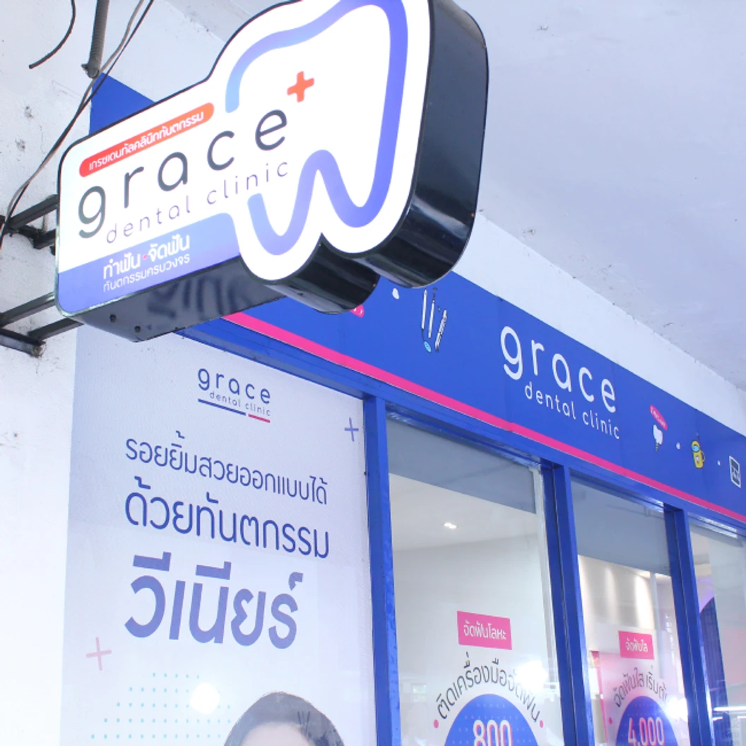 จัดฟันใส Clear Aligner ฟันบนหรือล่าง 1 เดือน (อุปกรณ์ 3 ชิ้น)