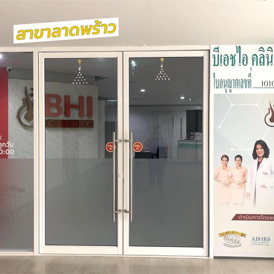 ปลูกผมเทคนิค FUE จำนวนกราฟต์ขึ้นอยู่กับแพทย์ประเมิน