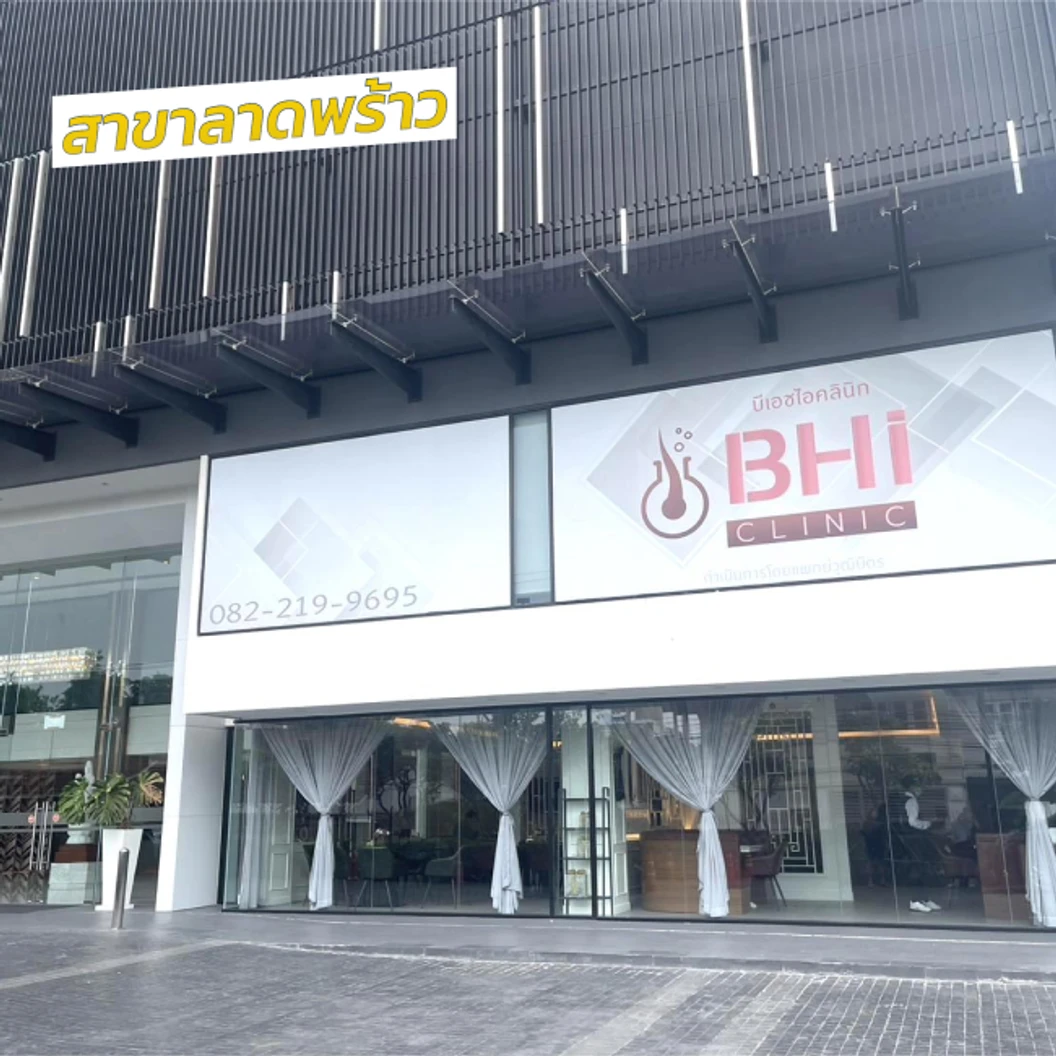 ปลูกผมเทคนิค FUE จำนวนกราฟต์ขึ้นอยู่กับแพทย์ประเมิน