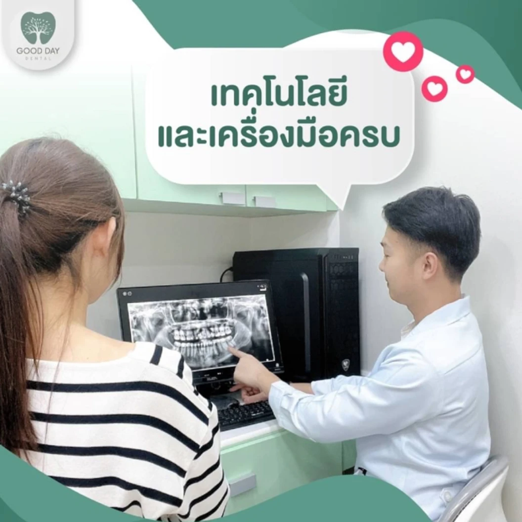 จัดฟันใส Invisalign Express 14 ชิ้น