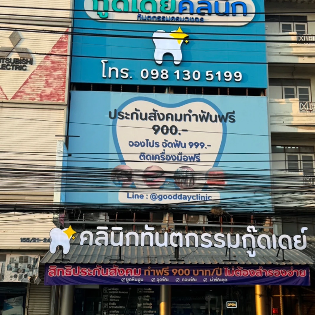 ถอนฟันคุด 1 ซี่ ราคาเดียว