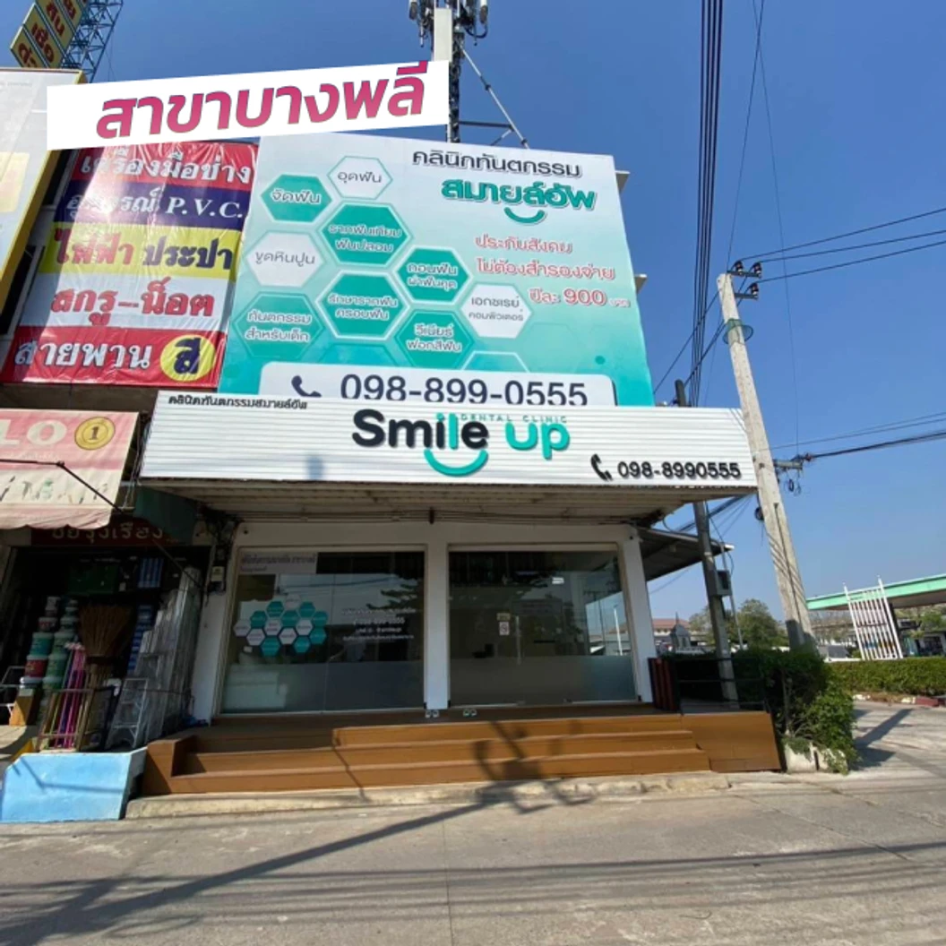 ขัดฟัน + เคลือบฟลูออไรด์ทั้งปาก