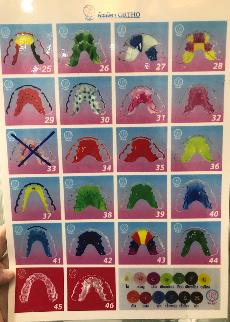 ทำรีเทนเนอร์แบบลวด 2 ชิ้น (บนและล่าง) พร้อมตรวจสุขภาพฟัน