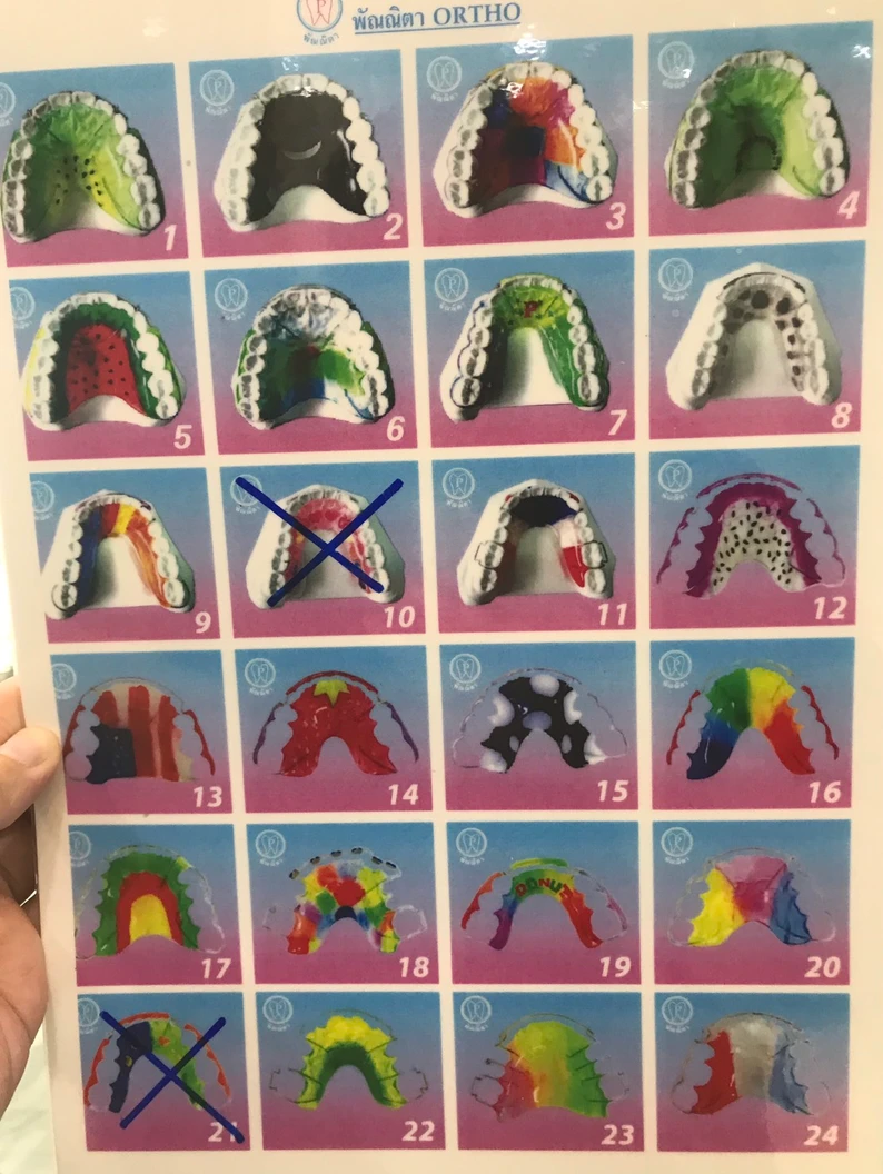 ทำรีเทนเนอร์แบบลวด 2 ชิ้น (บนและล่าง) พร้อมตรวจสุขภาพฟัน