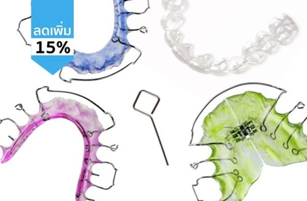 ทำรีเทนเนอร์แบบลวด 1 ชิ้น (บนหรือล่าง)