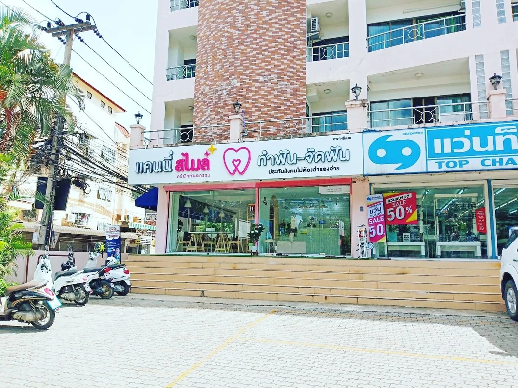 เคลือบผิวฟันและแปะฟันขาว ด้วยวีเนียร์คอมโพสิต 2 ซี่