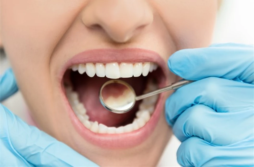 ขูดหินปูน พร้อมเคลือบฟลูออไรด์