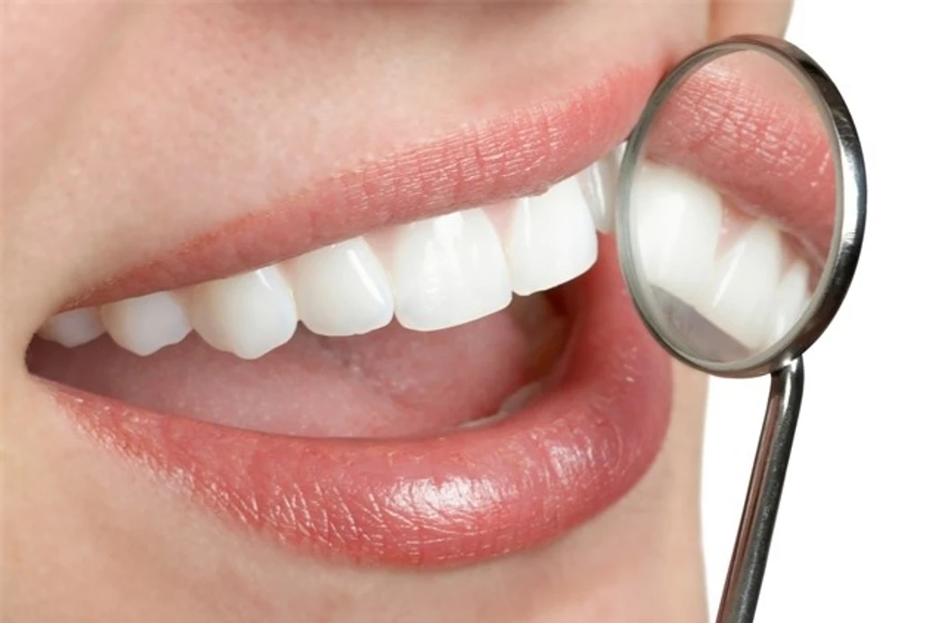 ฟอกสีฟัน ด้วยระบบ Cool Light