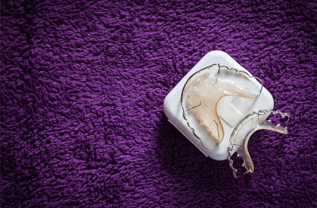 ทำรีเทนเนอร์แบบลวด 1 ชิ้น ฟันบนหรือล่าง