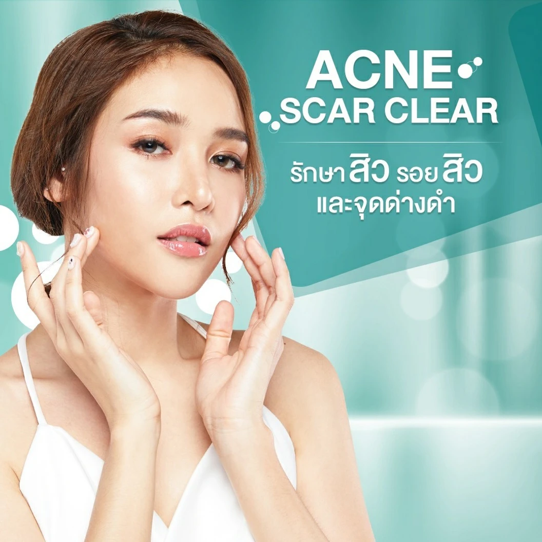 รักษาสิวและรอยสิว 7 ขั้นตอน 1 ครั้ง