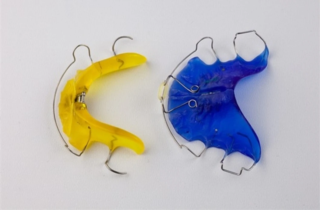 ทำรีเทนเนอร์ลวด 2 ชิ้น