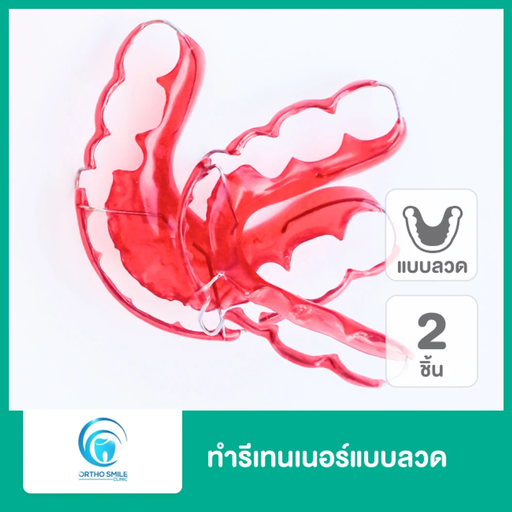 ทำรีเทนเนอร์แบบลวด 2 ชิ้น ฟันบนและล่าง