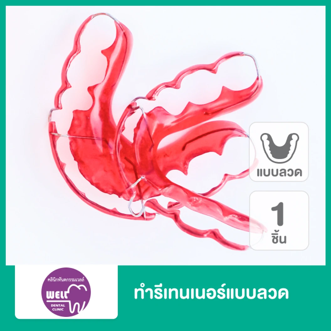 ทำรีเทนเนอร์แบบลวด 1 ชิ้น ฟันบนหรือล่าง