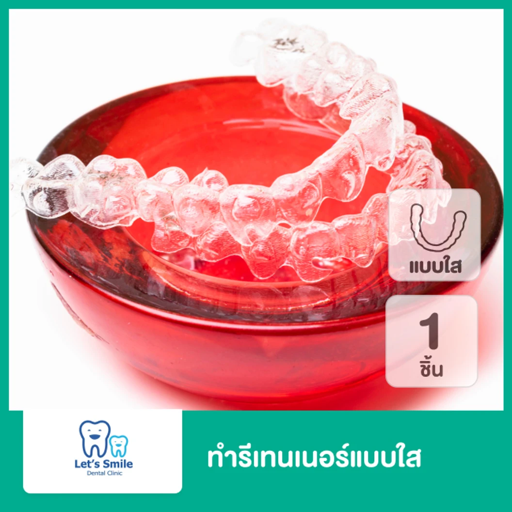 ทำรีเทนเนอร์แบบใส 1 ชิ้น ฟันบนหรือล่าง