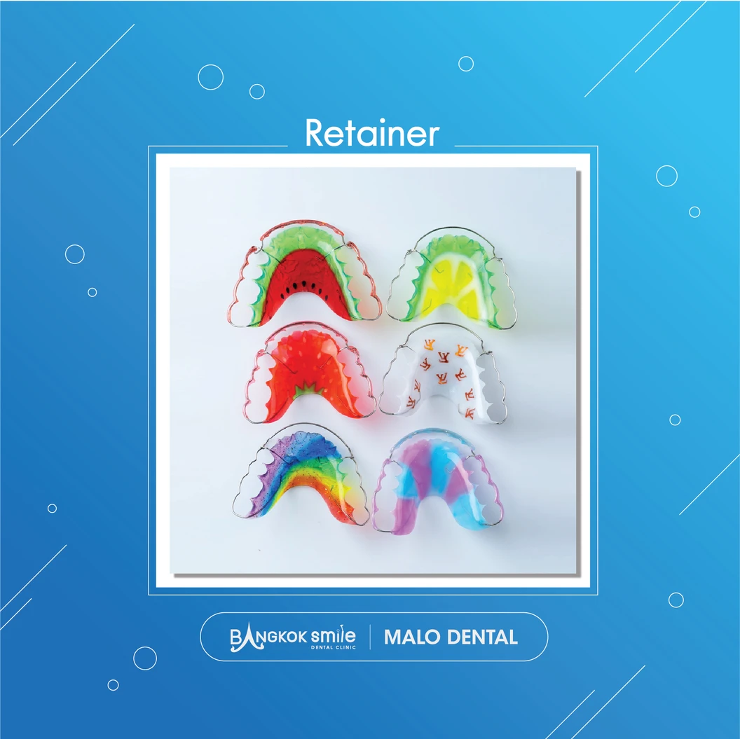 ทำรีเทนเนอร์แบบลวด 1 ชิ้น ฟันบนหรือล่าง