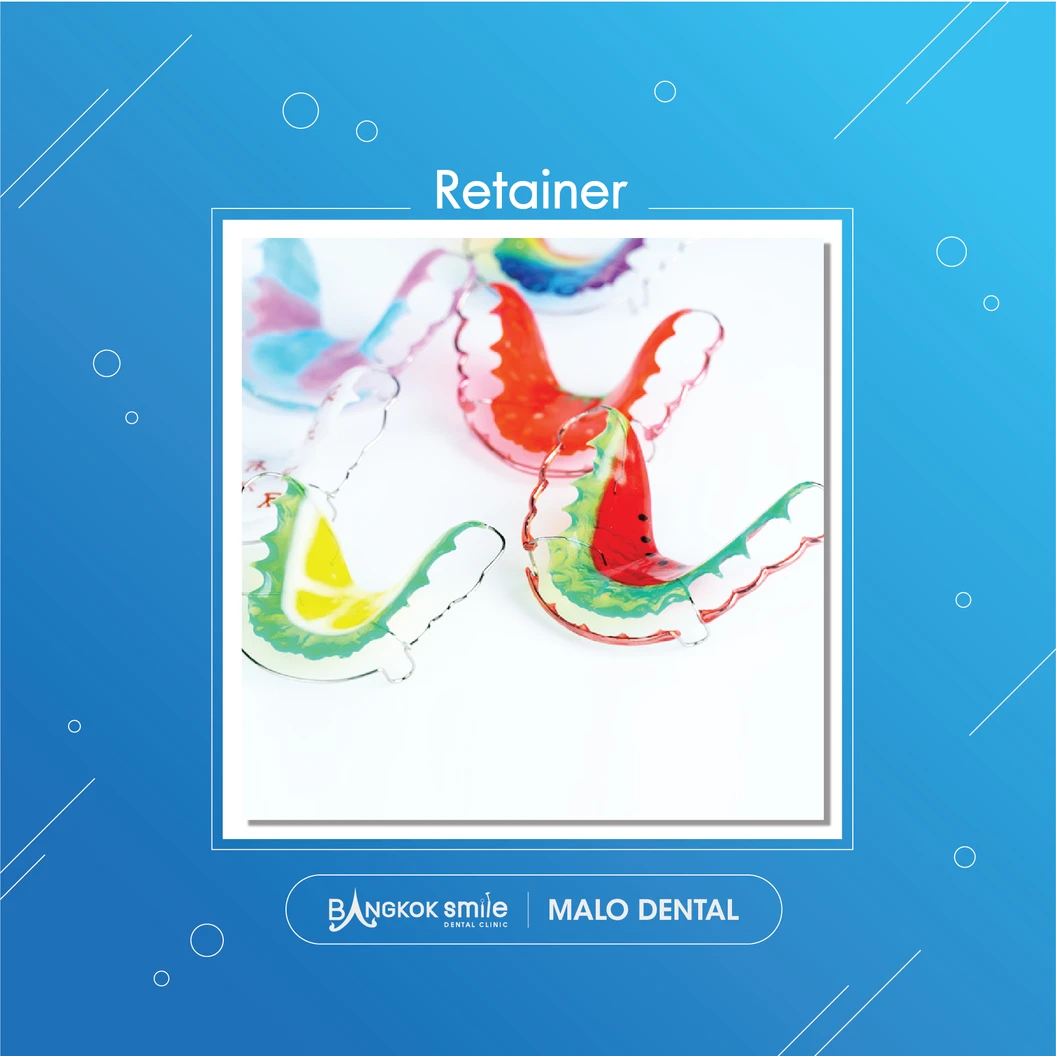 ทำรีเทนเนอร์แบบลวด 1 ชิ้น ฟันบนหรือล่าง