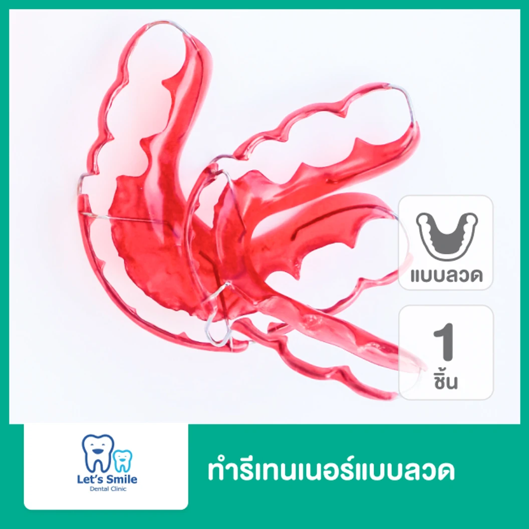 ทำรีเทนเนอร์แบบลวด 1 ชิ้น ฟันบนหรือล่าง