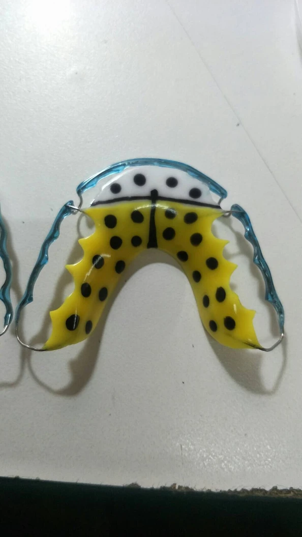 ทำรีเทนเนอร์แบบลวด 1 ชิ้น ฟันบนหรือล่าง