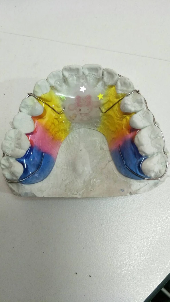 ทำรีเทนเนอร์แบบลวด 1 ชิ้น ฟันบนหรือล่าง