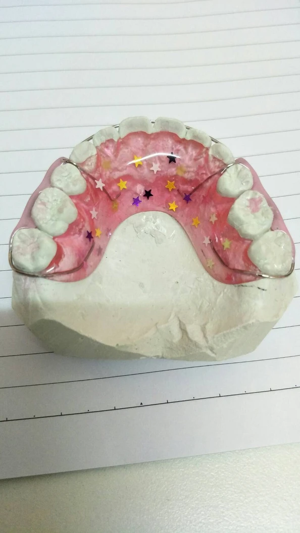 ทำรีเทนเนอร์แบบลวด 1 ชิ้น ฟันบนหรือล่าง