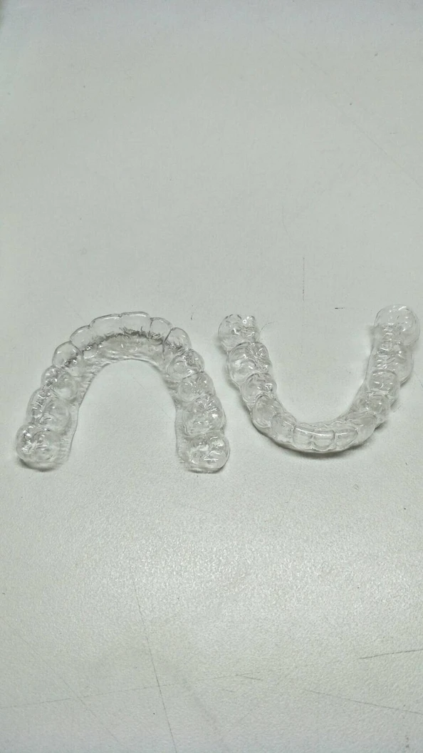 ทำรีเทนเนอร์แบบใส 1 ชิ้น ฟันบนหรือล่าง