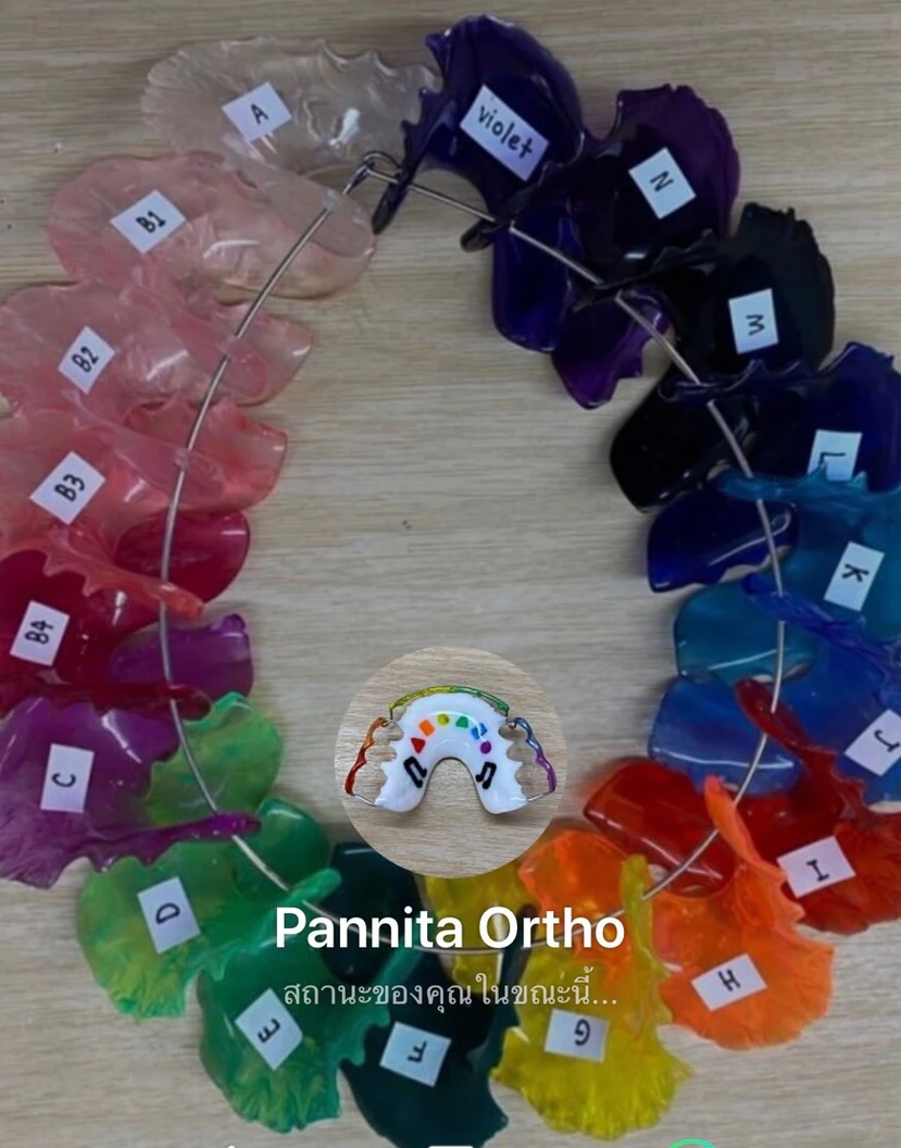 ทำรีเทนเนอร์แบบลวด 1 ชิ้น ฟันบนหรือล่าง