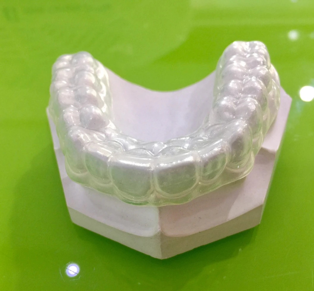 ทำรีเทนเนอร์แบบใส 1 ชิ้น ฟันบนหรือล่าง