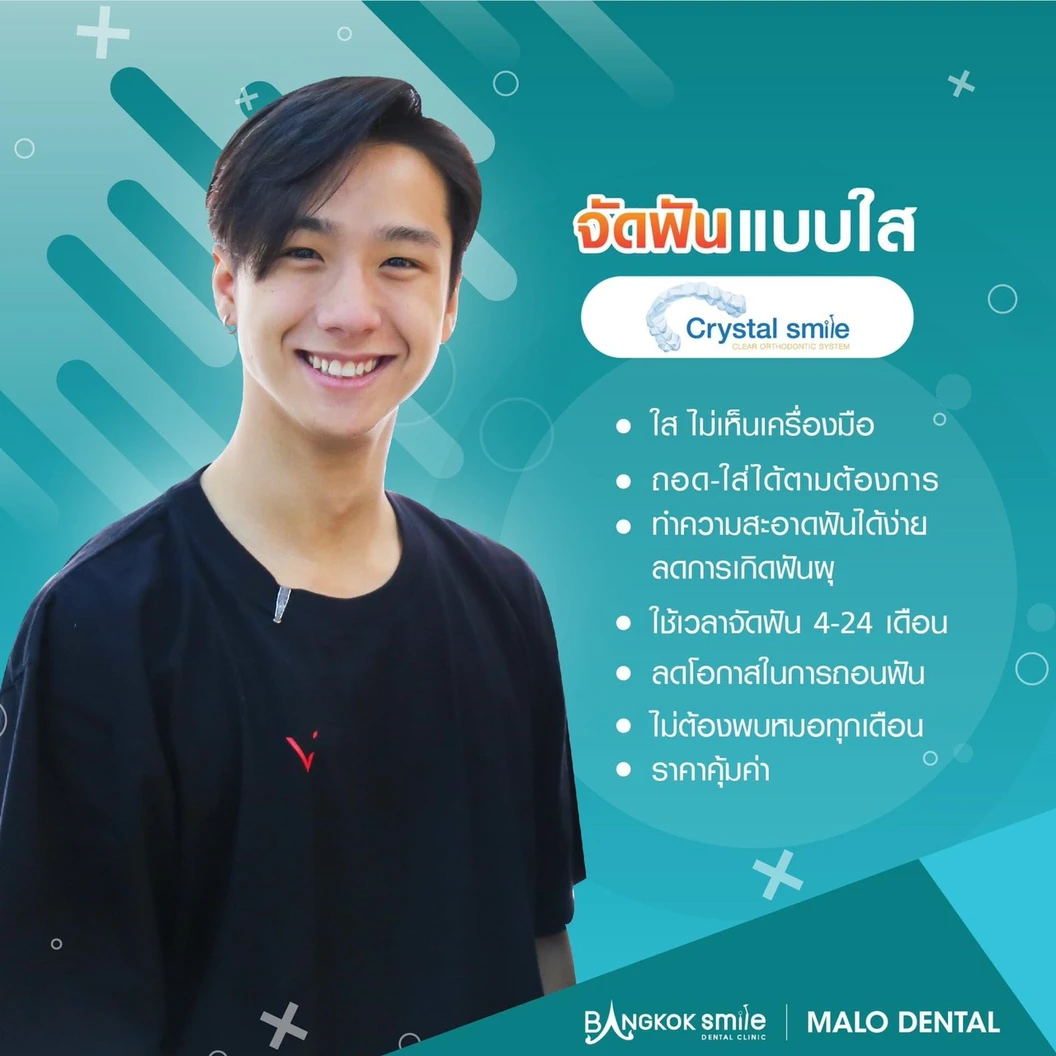 คอร์สจัดฟันแบบใส Invisalign Express ฟันบนและล่าง เครื่องมือ 14 ชิ้น