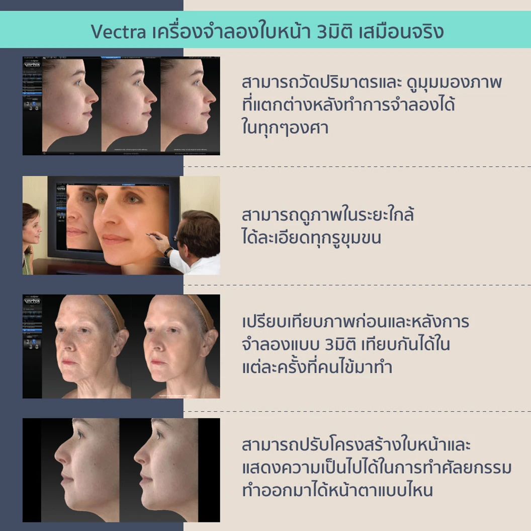 เสริมคาง สำหรับเคสเสริมครั้งแรก