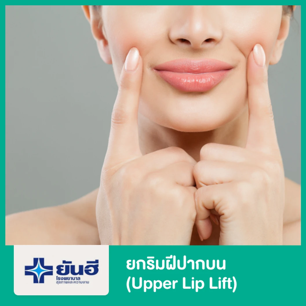 ยกริมฝีปากบน (Upper Lip Lift)