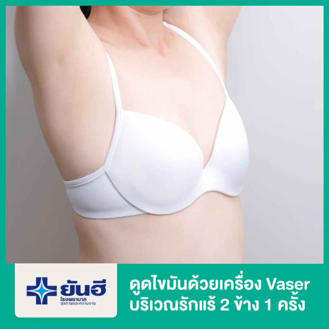 โปรแกรมดูดไขมันด้วยเครื่อง Vaser บริเวณรักแร้ 2 ข้าง 1 ครั้ง