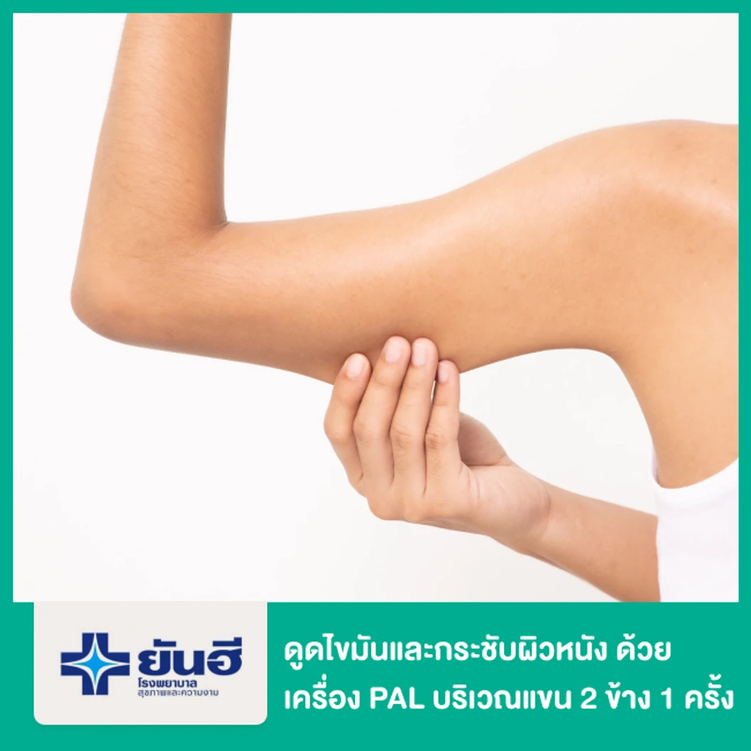 โปรแกรมดูดไขมันและกระชับผิวหนัง ด้วยเครื่อง PAL และ Renuvion บริเวณแขน 2 ข้าง 1 ครั้ง