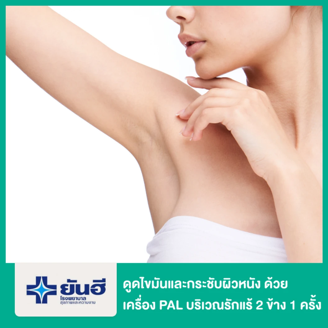 โปรแกรมดูดไขมันและกระชับผิวหนัง ด้วยเครื่อง PAL และ Renuvion บริเวณรักแร้ 2 ข้าง 1 ครั้ง