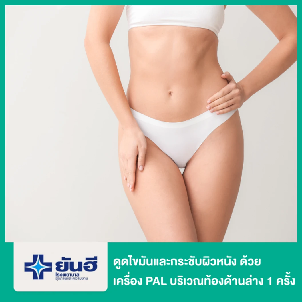 โปรแกรมดูดไขมันและกระชับผิวหนัง ด้วยเครื่อง PAL และ Renuvion บริเวณท้องด้านล่าง 1 ครั้ง